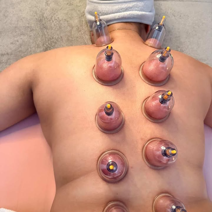 Massage relaxant + Pose de ventouses effet renforcé (dos)