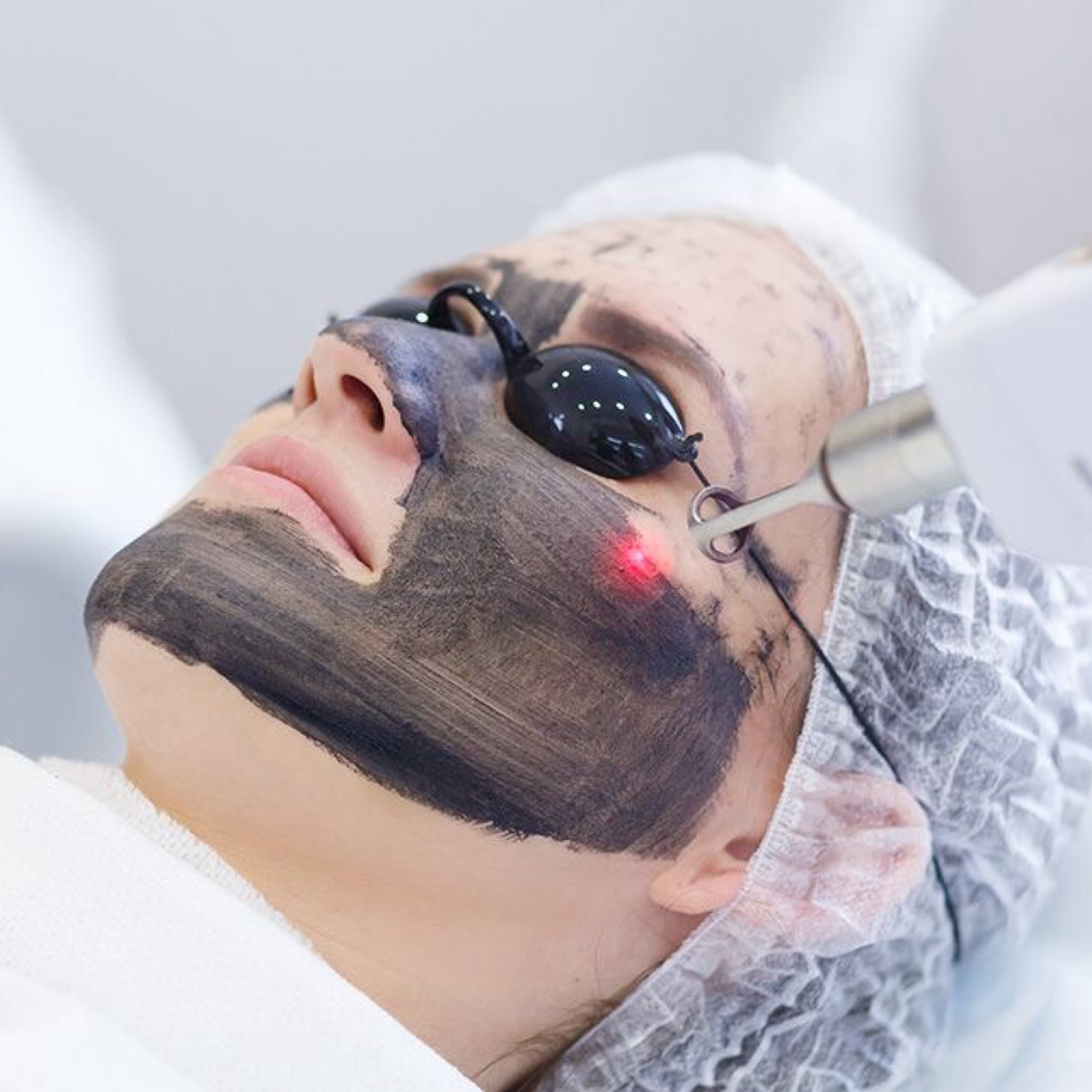 Hollywood Black Carbon Peel