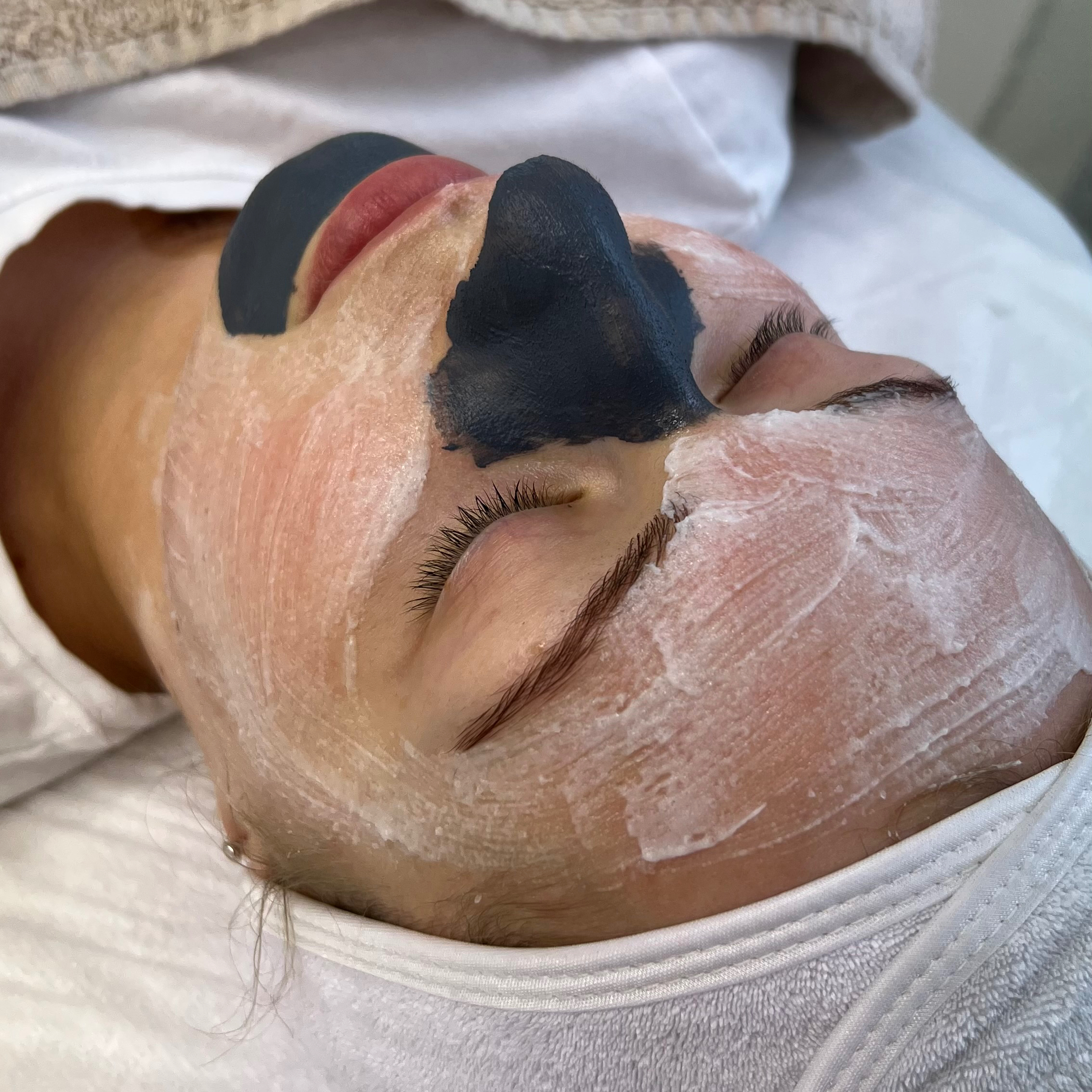 KOSMETICKÉ OŠETŘENÍ ALL-INCLUSIVE