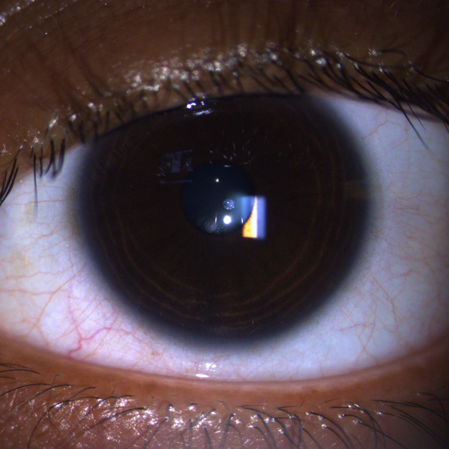 Consultation at The Eye Clinic - GENERAL