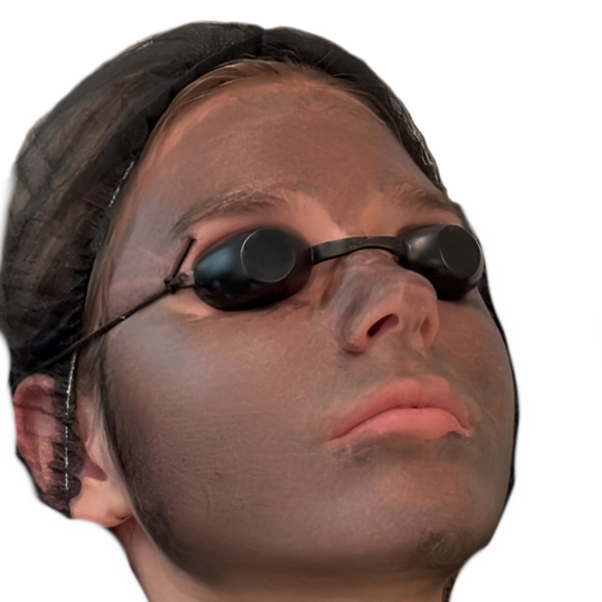 * Carbon Laser * Hollywood mask * Black Doll Facial 69