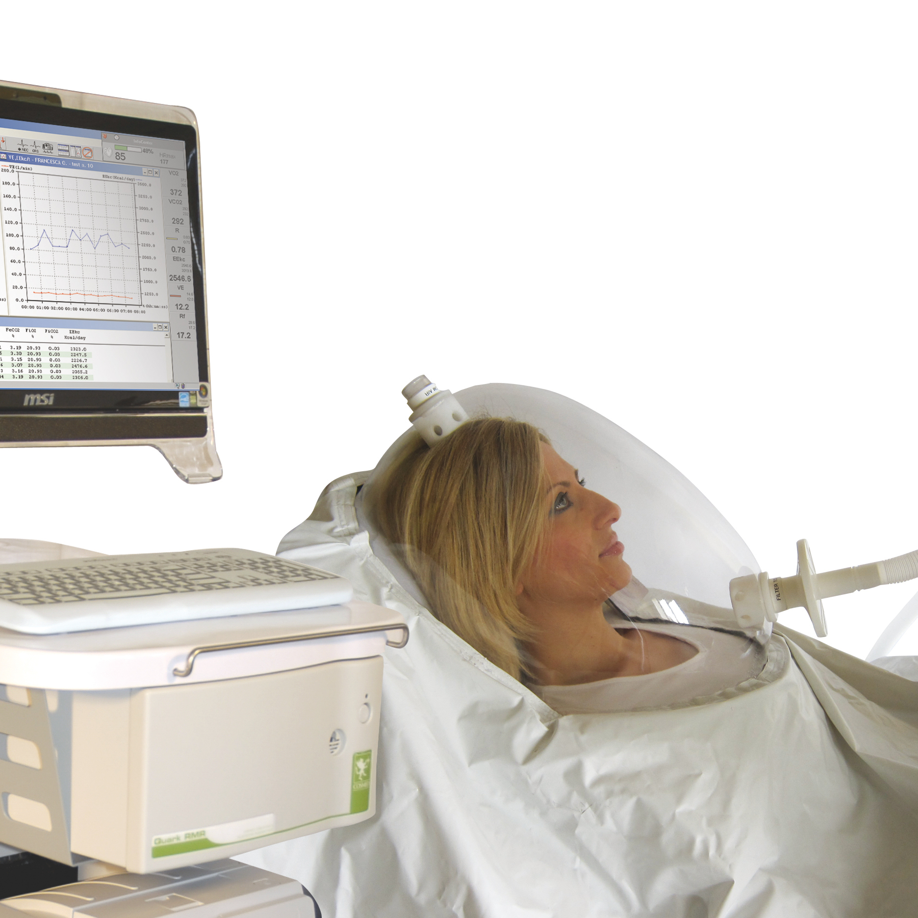 Nepriama kalorimetria