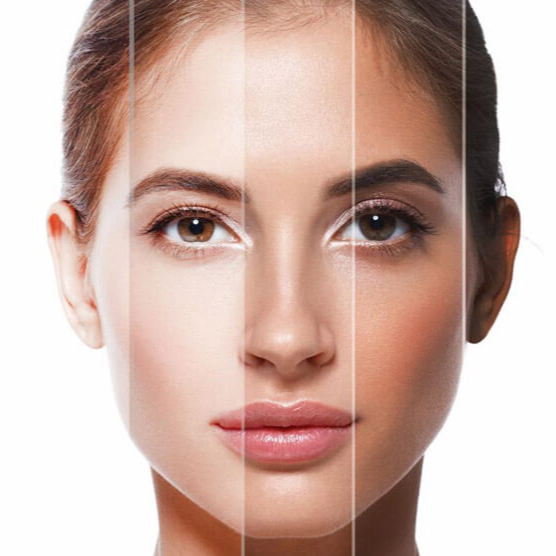 SMART sessão solario+colagéneo 28M