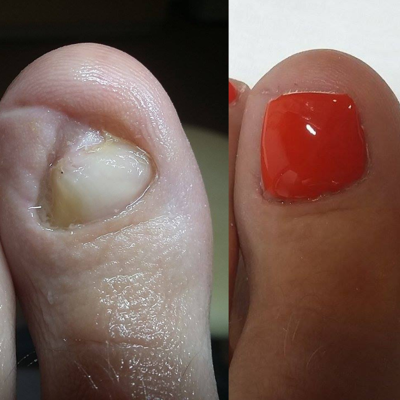 Pedikúra + gél lak + špona