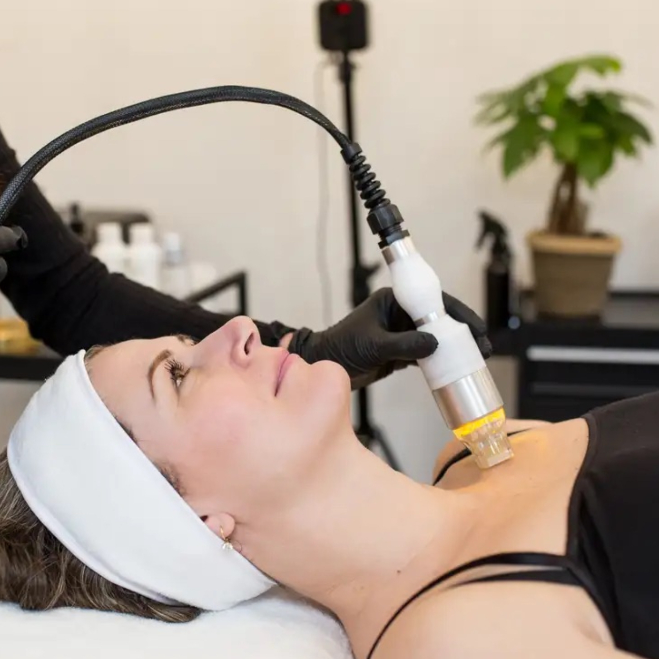 Mikroihličková frakčná Radiofrekvencia - vnút. / vonk. stehná /