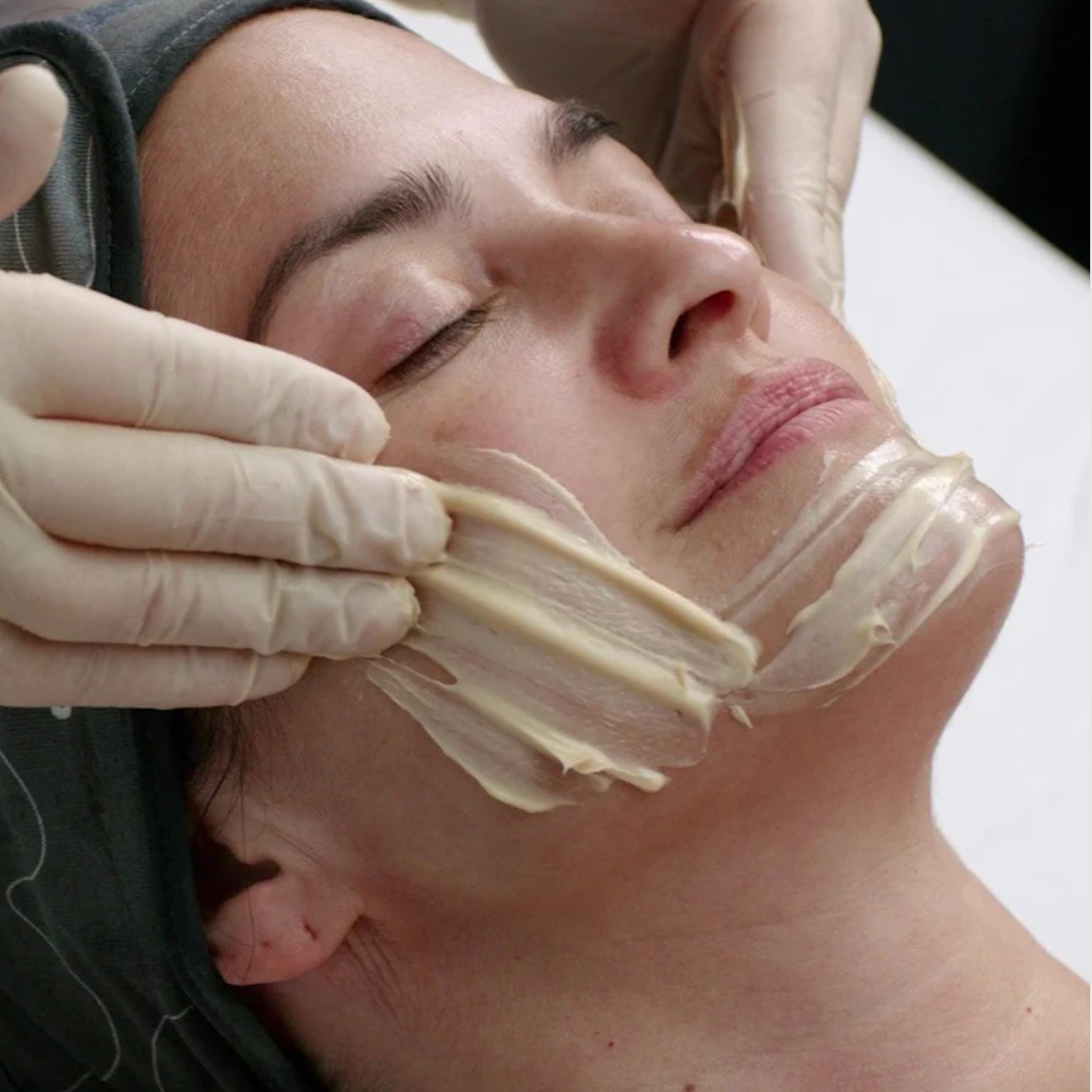 Melanopro Peel System