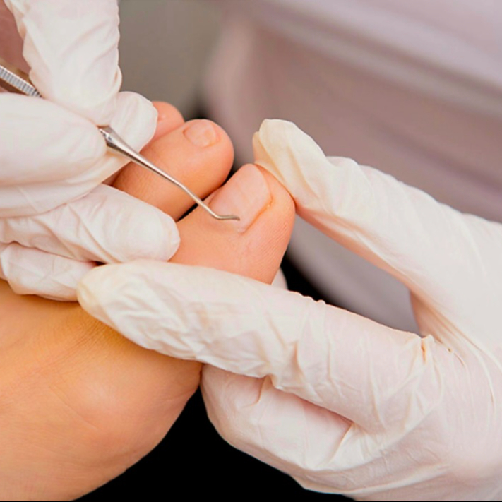 Medizinische Pediküre + Fußpflege