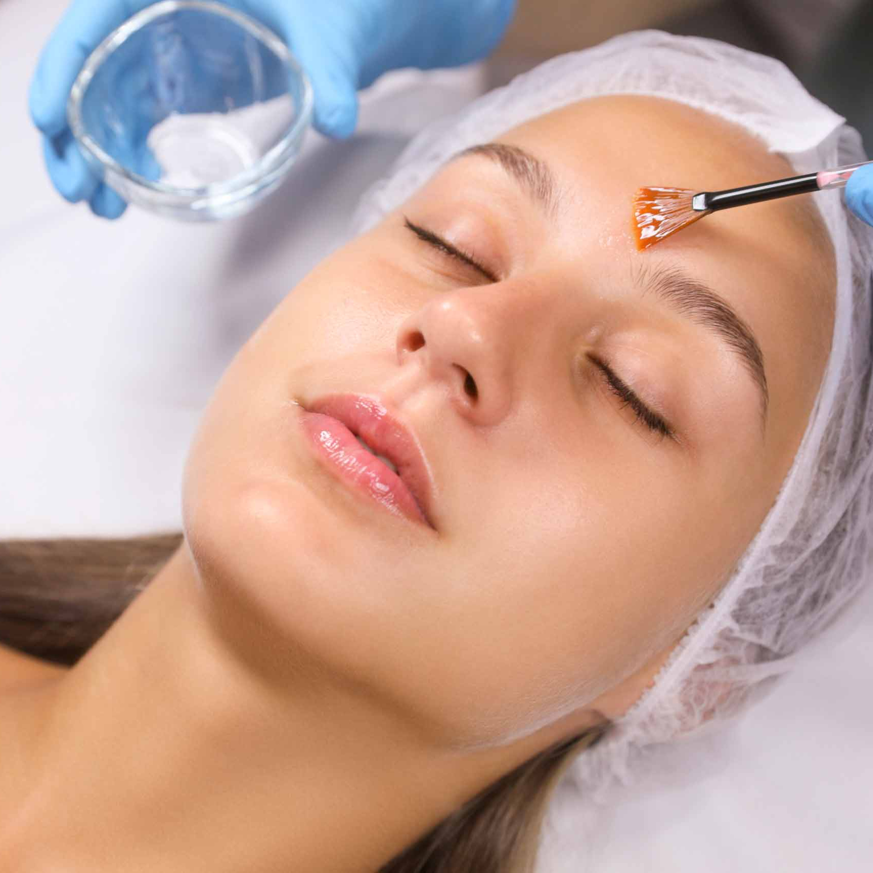 Terapia de ácidos 5 sesiones