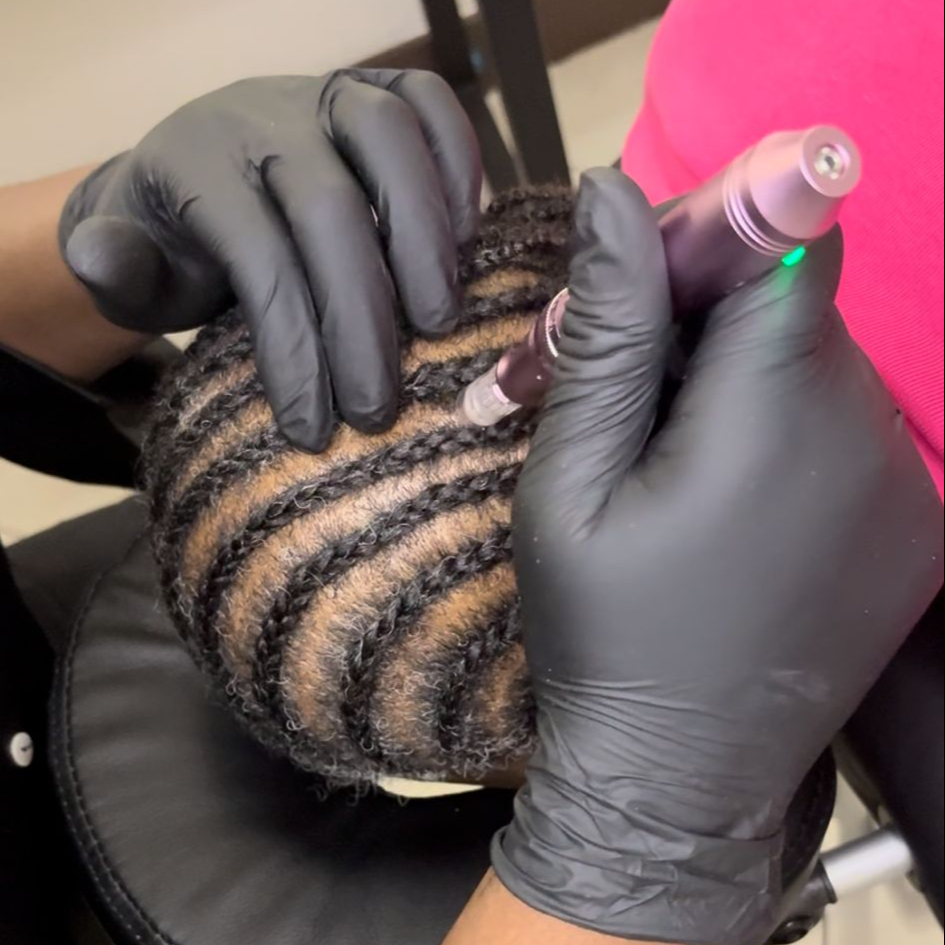 Hairneedling - Tête entière - Forfait 6 séances