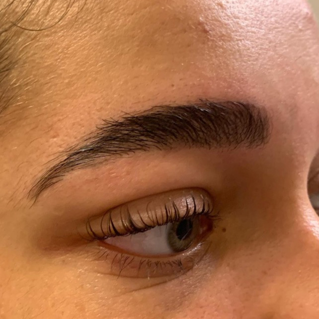 BROW LIFT