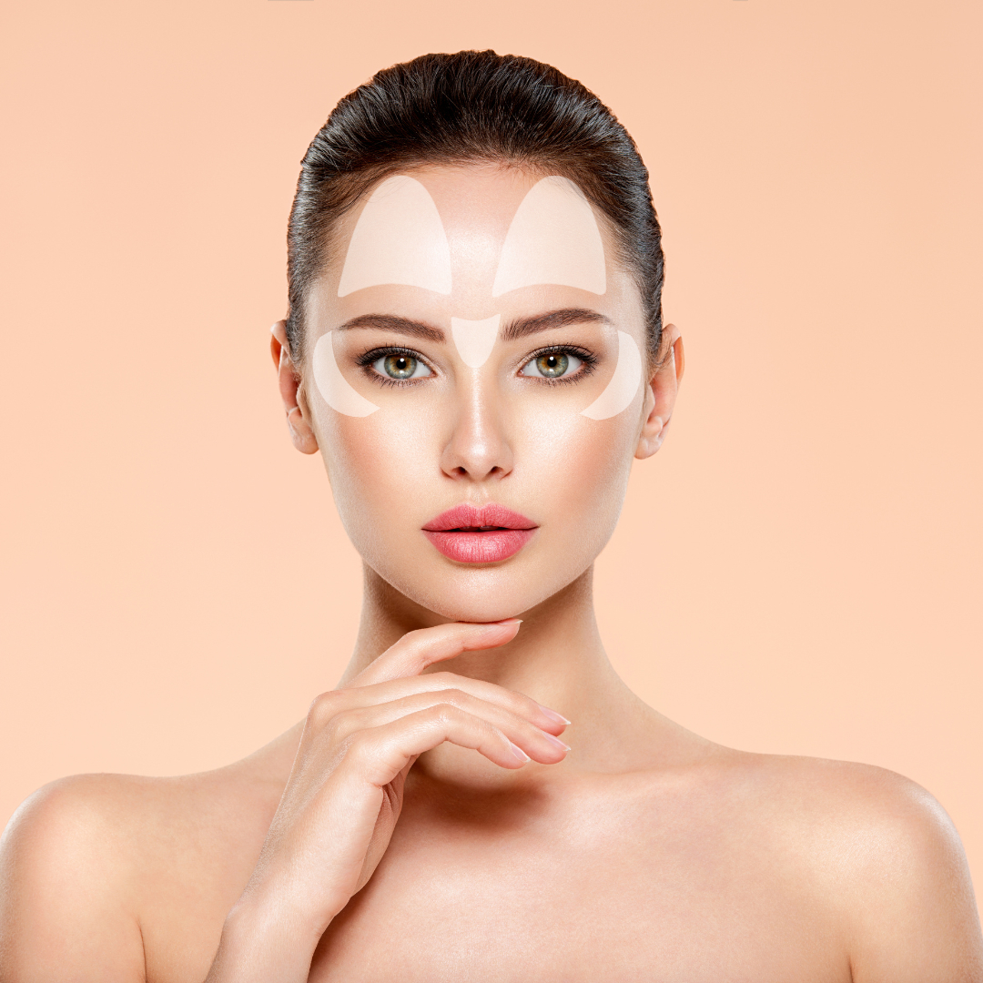 BOTOX Kezelés 3 Terület