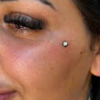 Microdermal