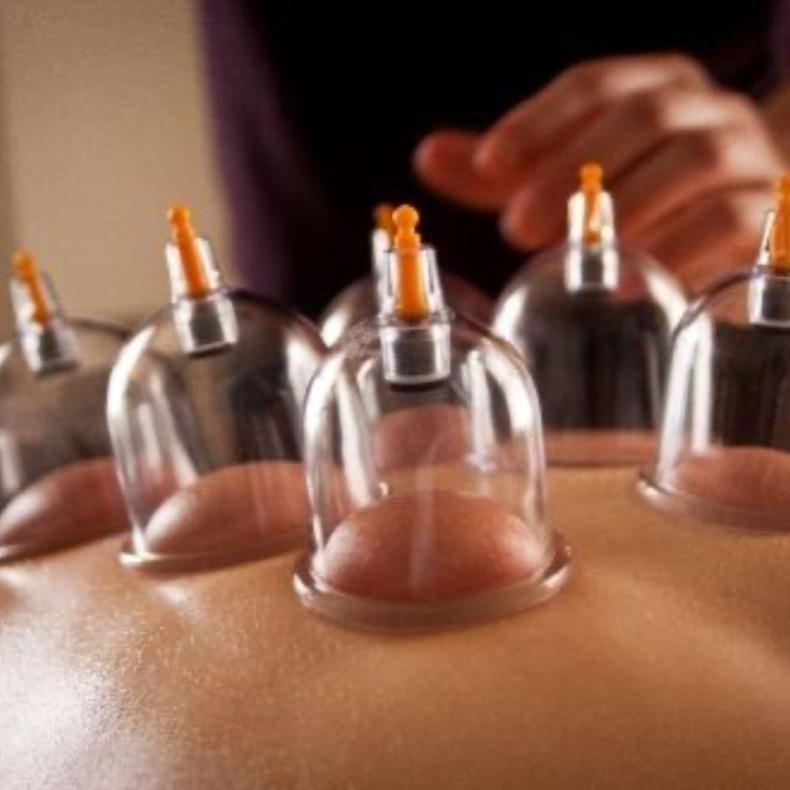 Köpölyözés (kiegészítő technika)