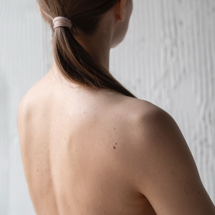 Chemický peeling - chrbát