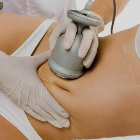 Cavitación +presoterapia