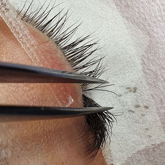 REMOÇÃO DE EXTENSÃO