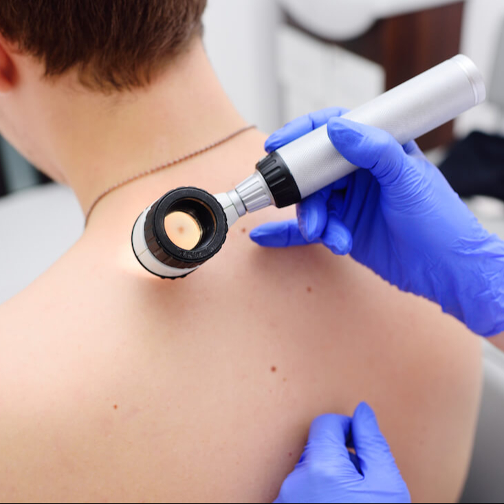 Osservazione dermatologica in epiluminescenza