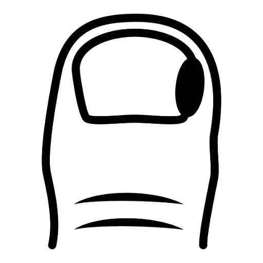 Ošetření zarostlého nehtu