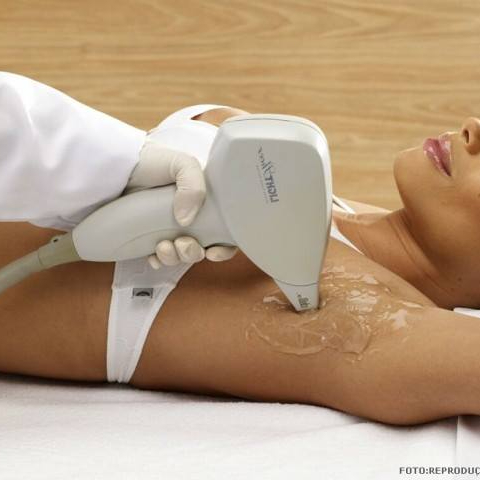 Depilação Laser SHR Axilas