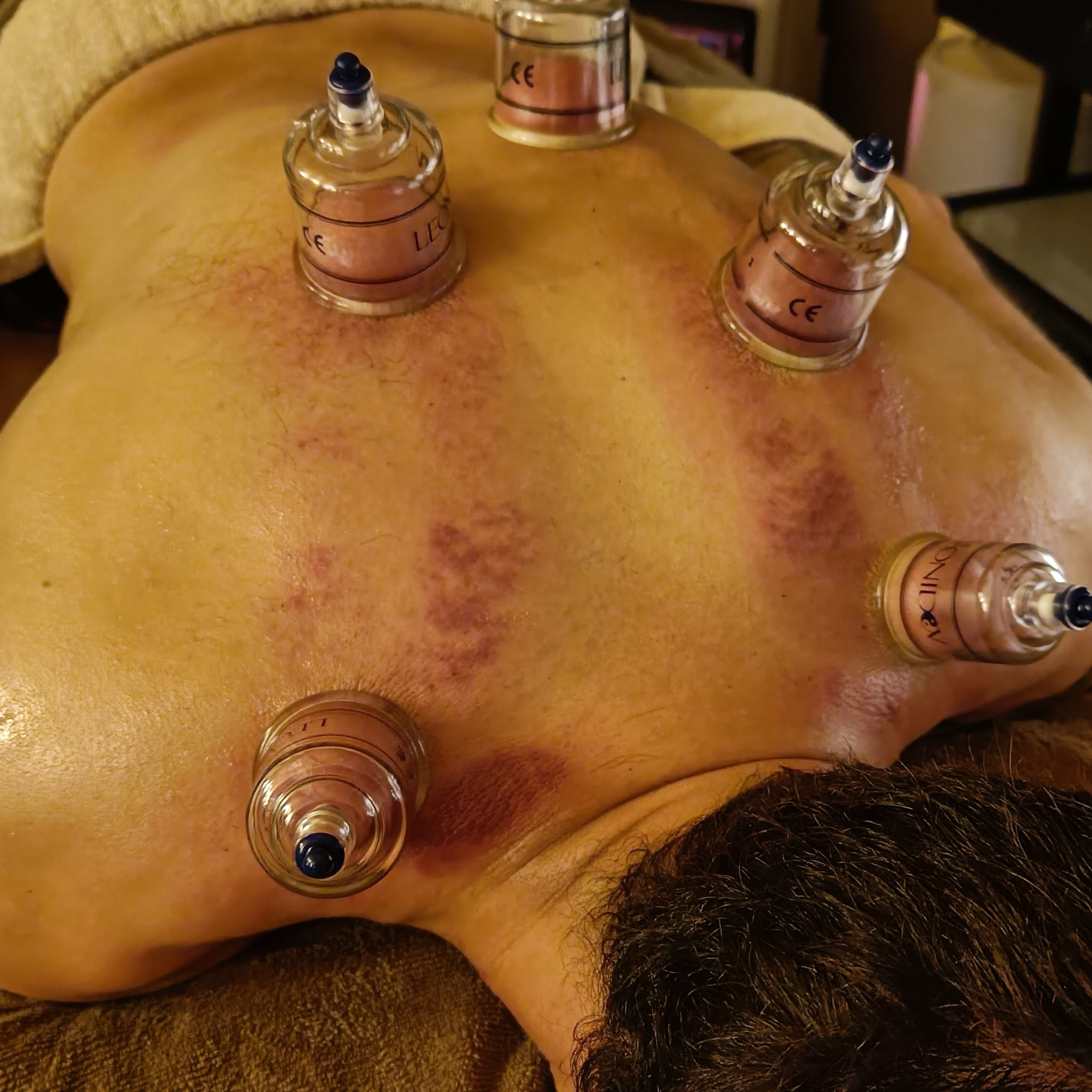 Cupping Massage Rug, Nek & Schouders
