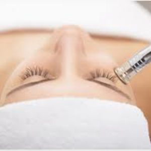 Diamant Microdermabrasion