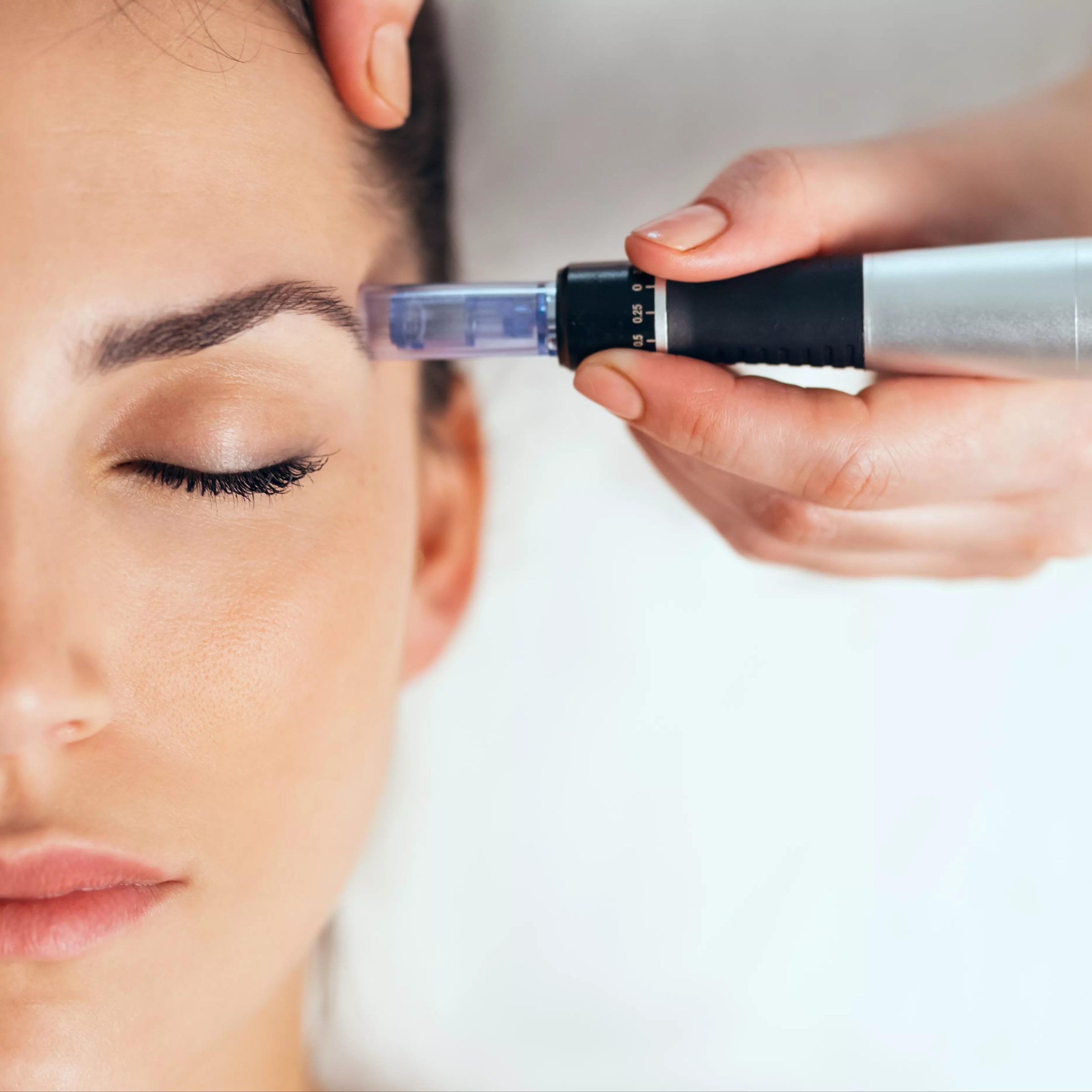 Mikrojehličkování s koktejlem (DERMAPEN)/Микронидлинг с коктейле