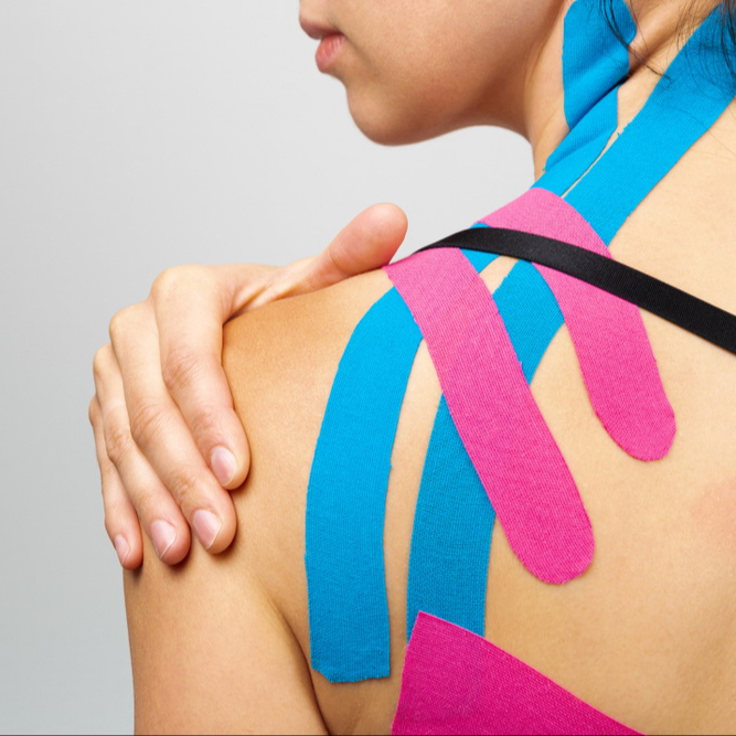 Kineziotaping