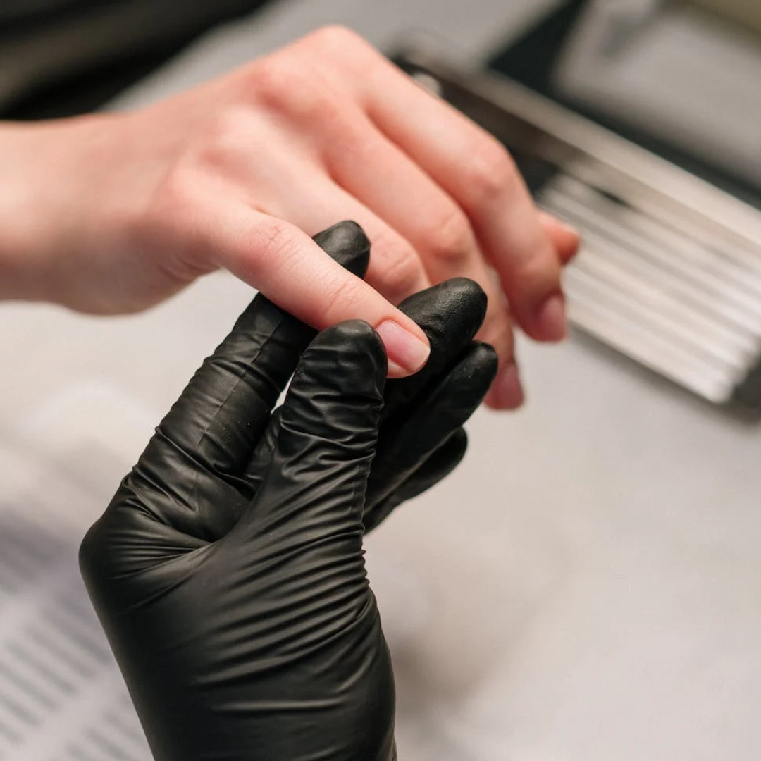 REMOÇÃO ALONGAMENTO