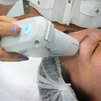 UltheraLIFT okolí očí