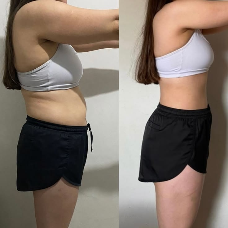 Body Sculpting Magic Reductor