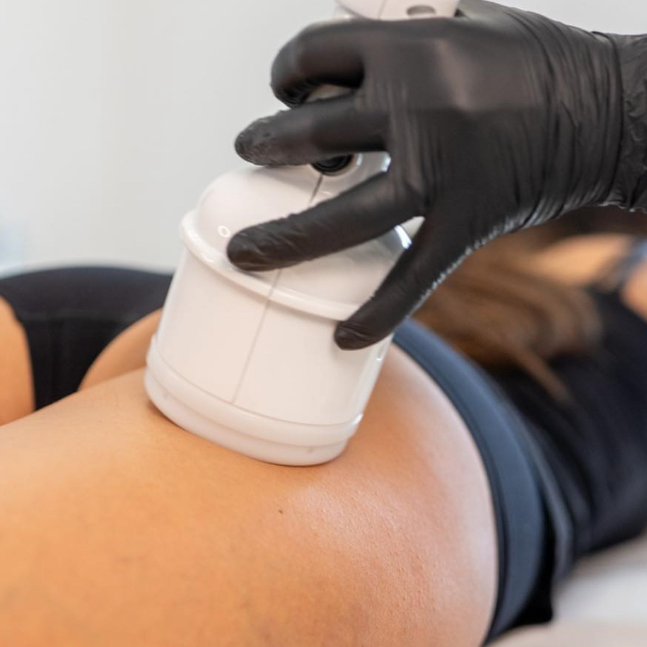 SONOBEAT - VACUUM NOHOU