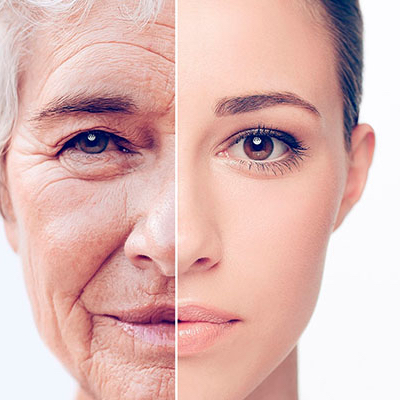 Tekuty laser/Жидкий лазер