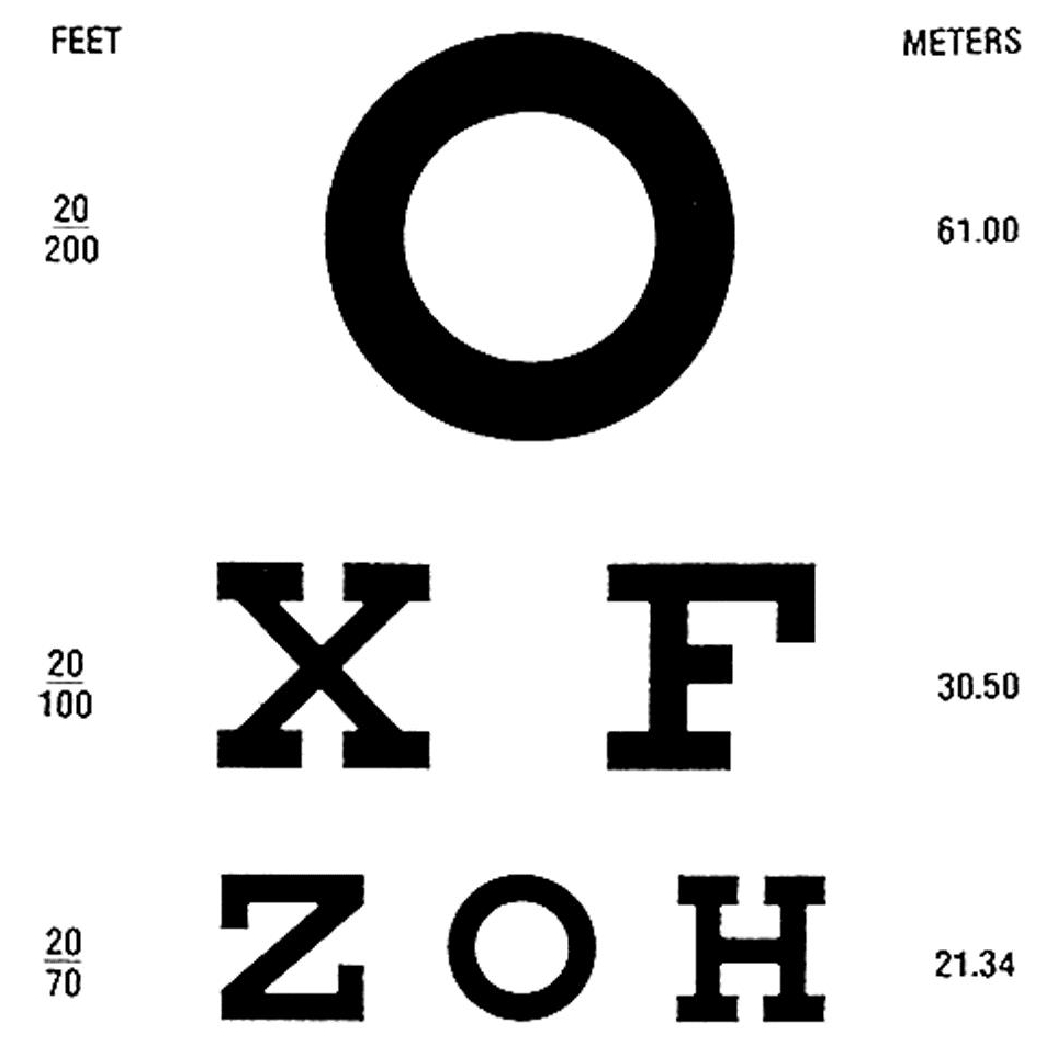 Basic Vision Assessment