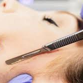 DERMAPLANING