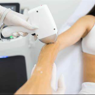 Depilação Laser SHR Antebraço