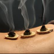 Moxibustion