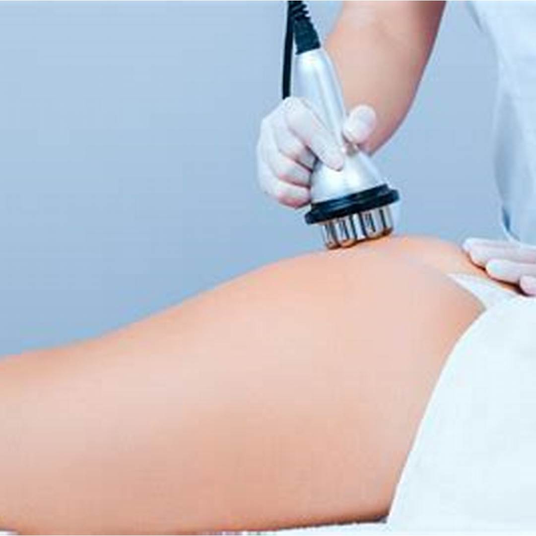 Radiofrequência Corpo - 3 zonas