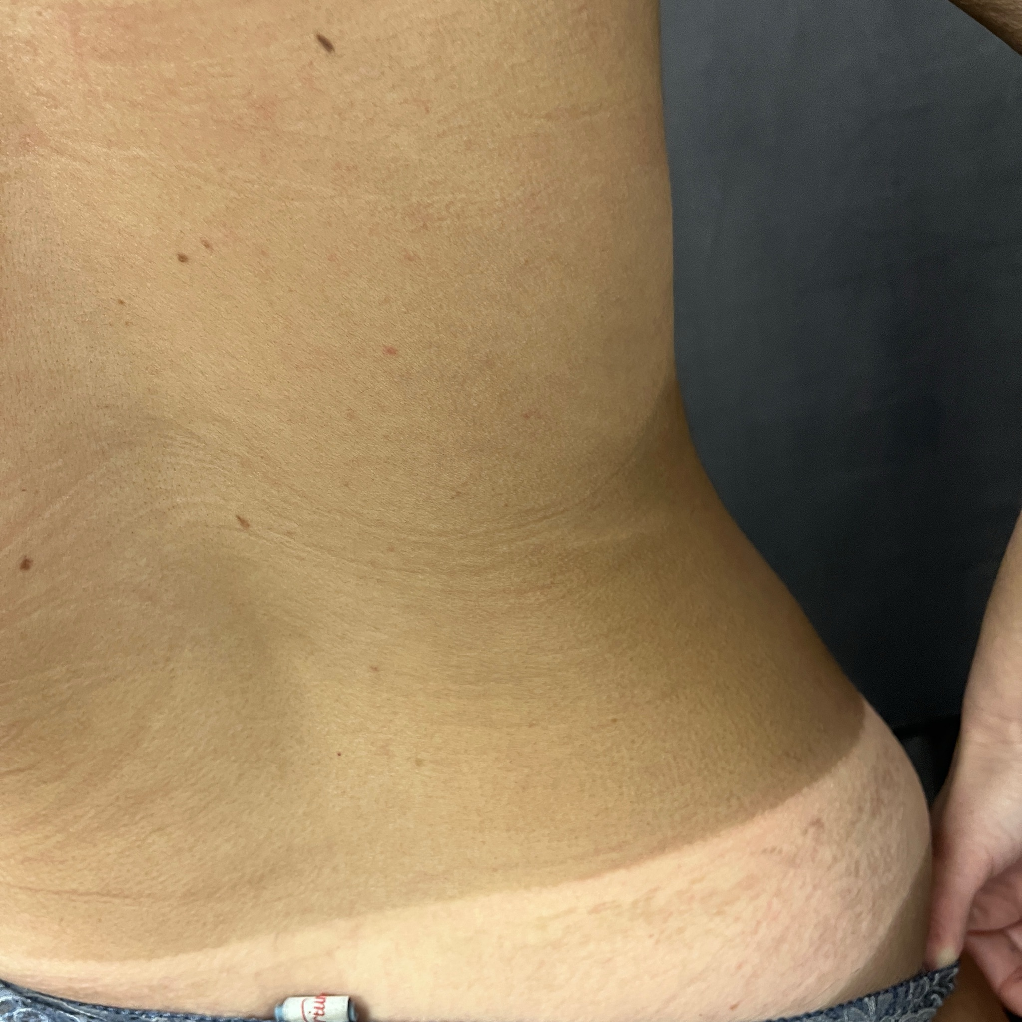 Bronzage sans uv Intégral médium