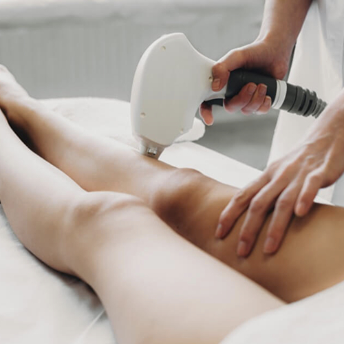 Laserová epilace - S