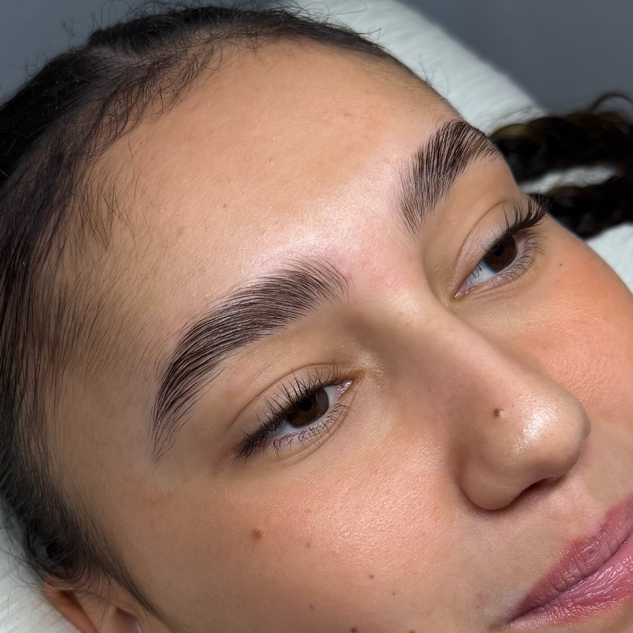 Browlift seul