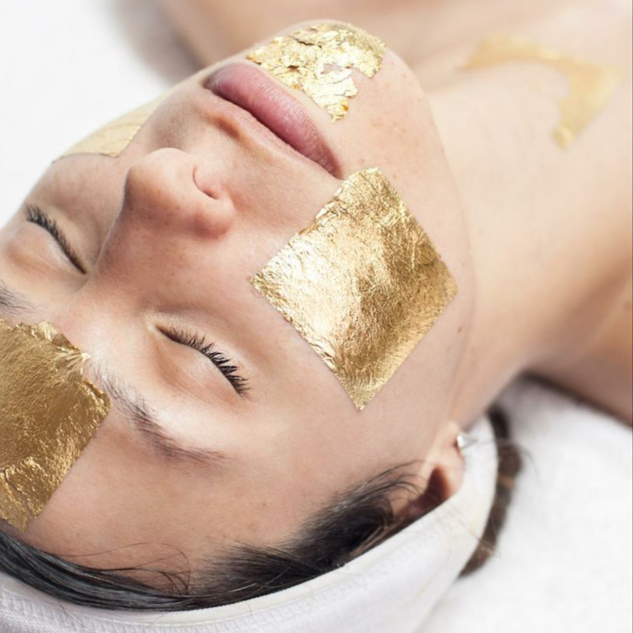Královská Gold Therapy + přístrojové oš. IPL