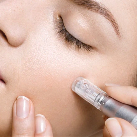 Mezoterapie-obličej