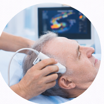 ecocolordoppler transcranico/capo