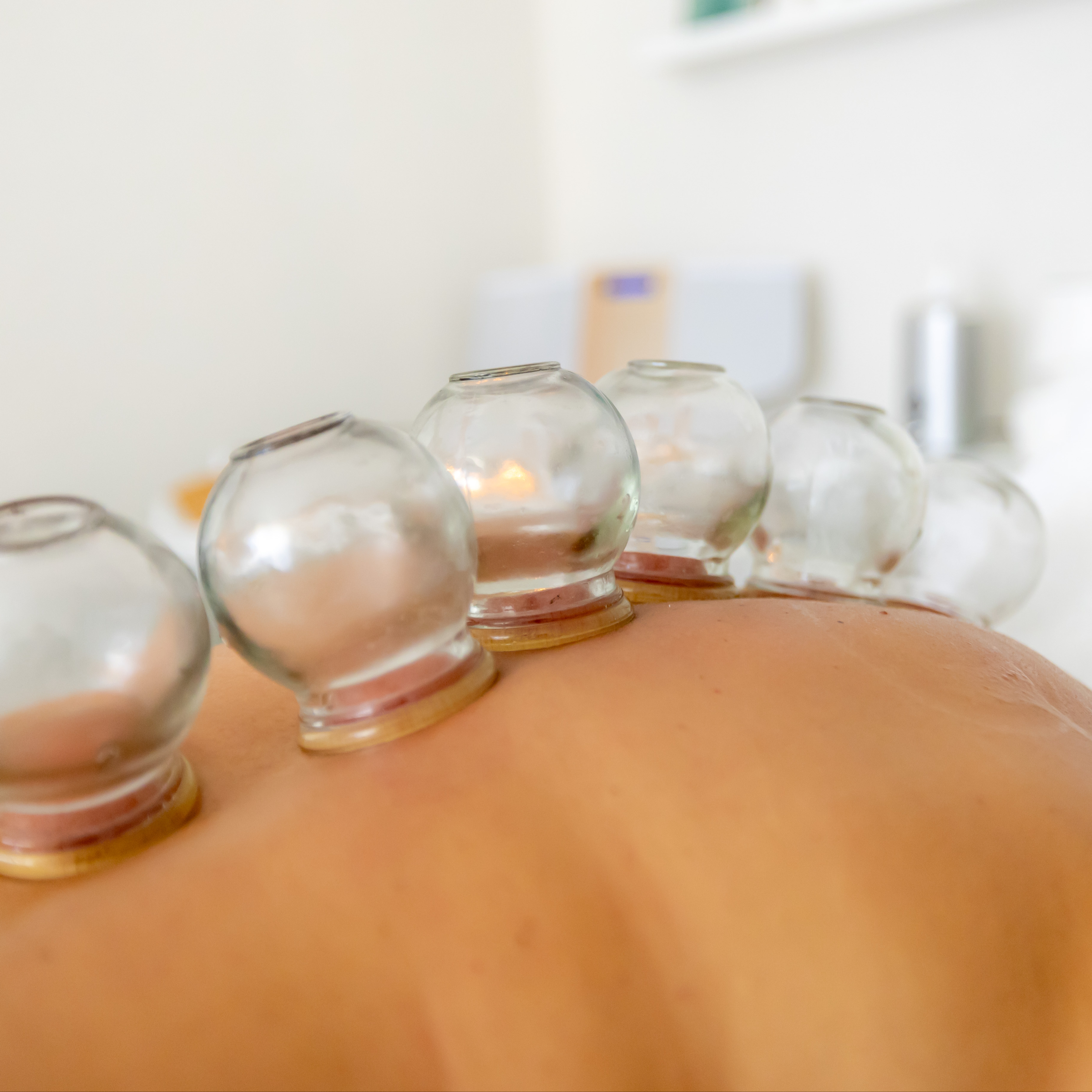 Bankovanie - vákuová masáž + masáž chrbta 60 minút