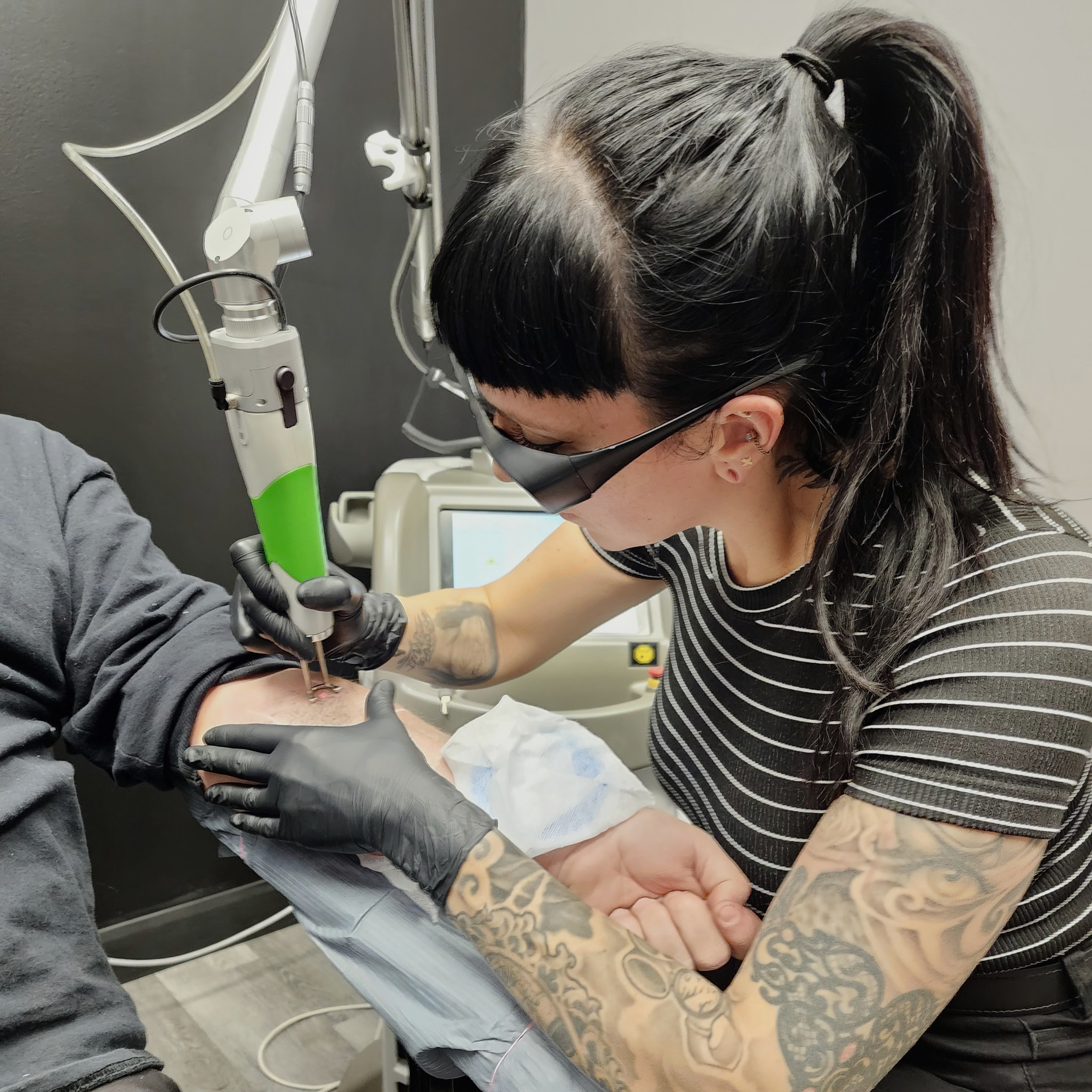 Détatouage - Pour nos clients en cours de traitement.