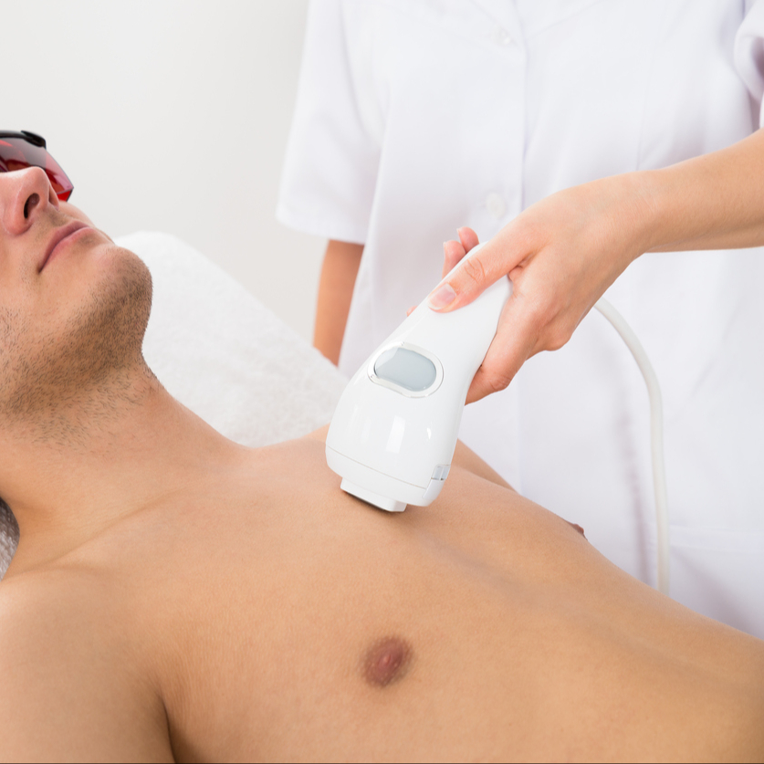 Depilação a Laser