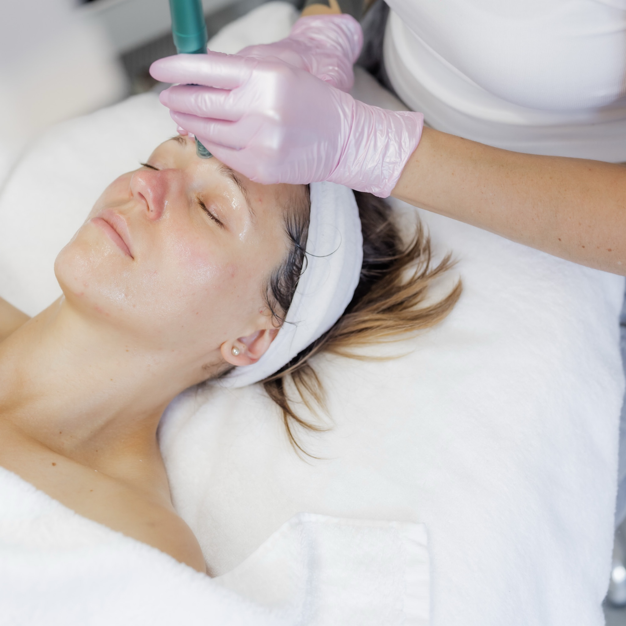 Mikrojehličky obličej+krk