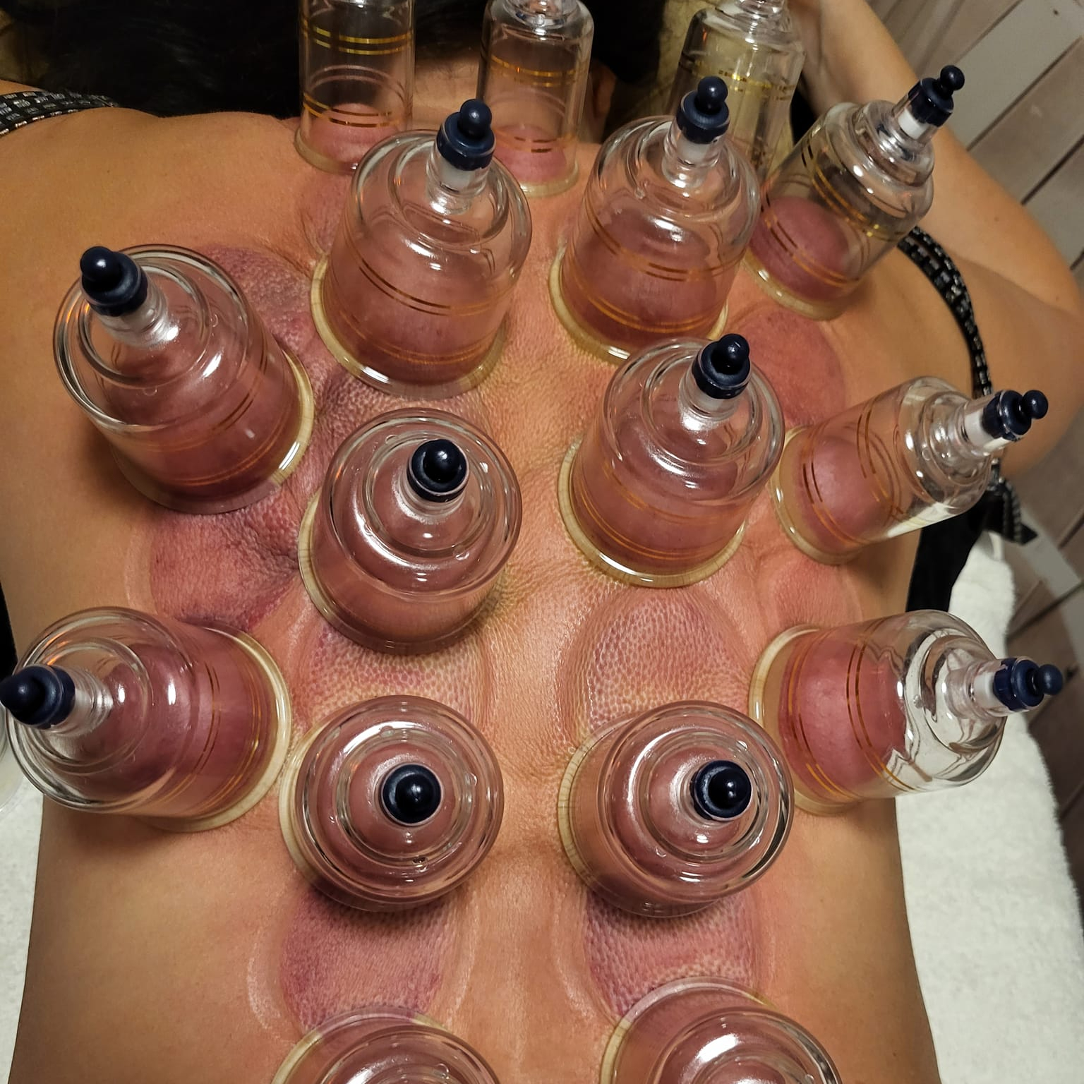 Massage Soin aux ventouses ( Cupping Thérapie) 1 h