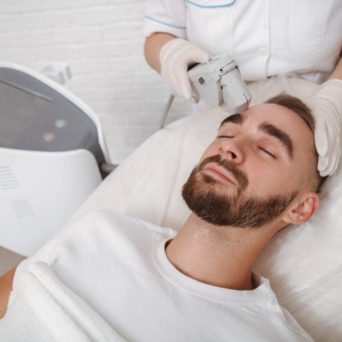 Depilação Laser SHR Entre Sobrancelhas (Homem)