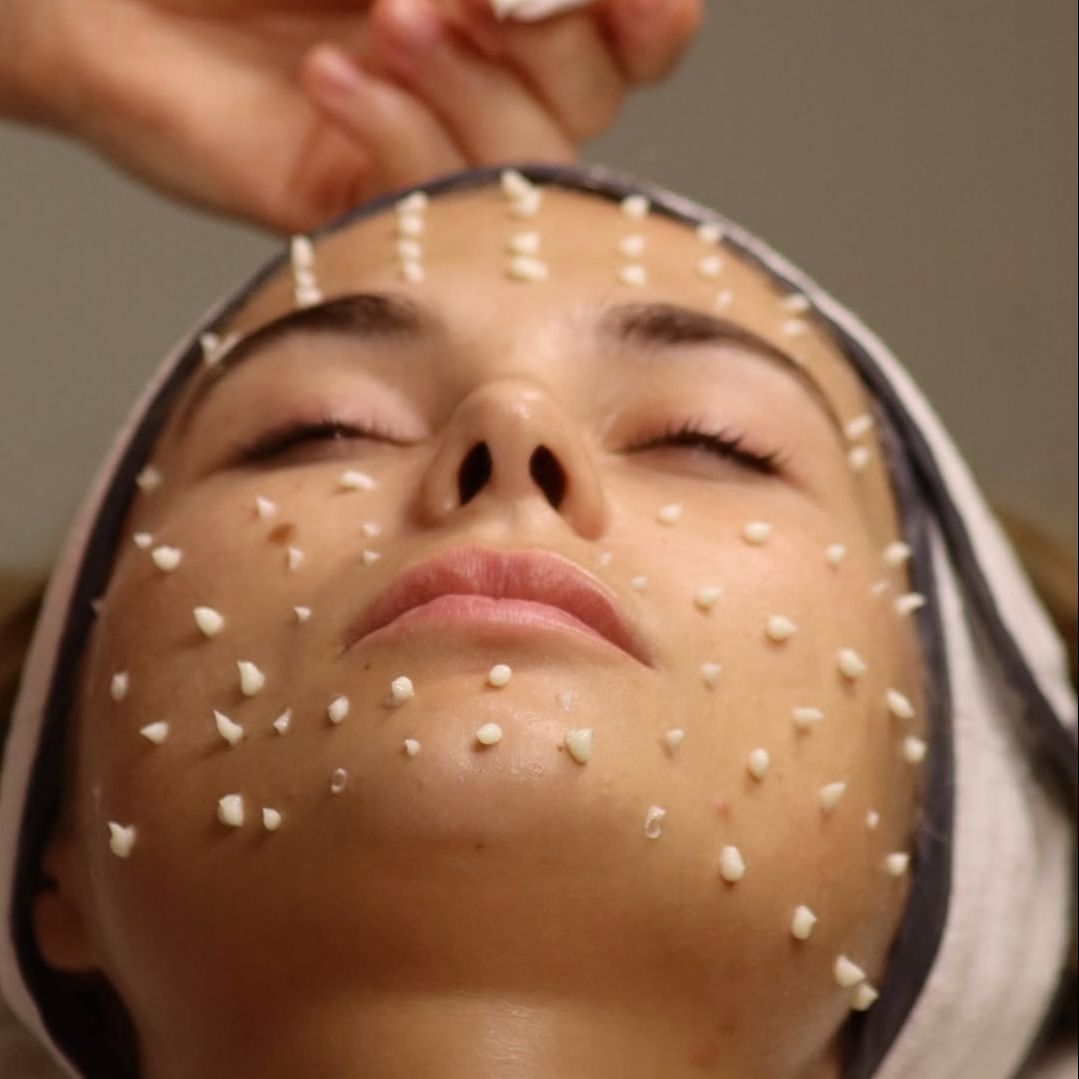 NOVINKA! Neinvazivní mezoterapie Cellstory - 70 min